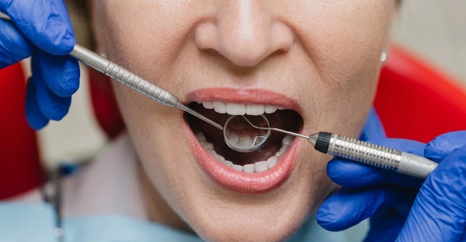 how to get feeling back in mouth after dentist 2